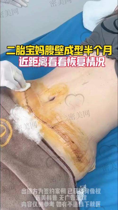 初访门诊：感受徐礼亮医生的专精魅力