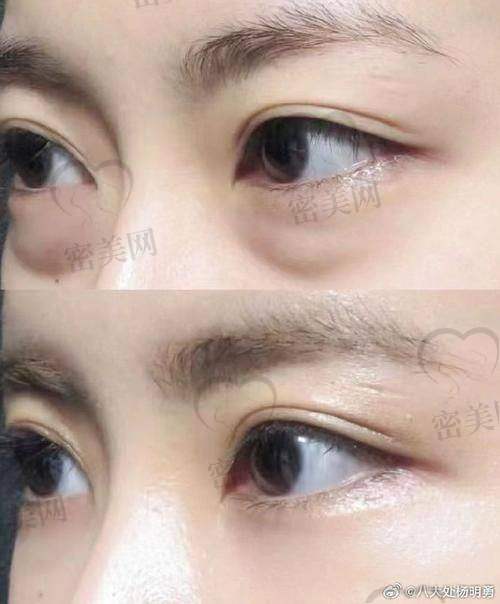 选择合适的医美机构和医生