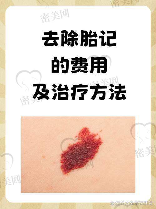 口碑爆棚！重庆军科党永明5000元祛胎记获无数点赞