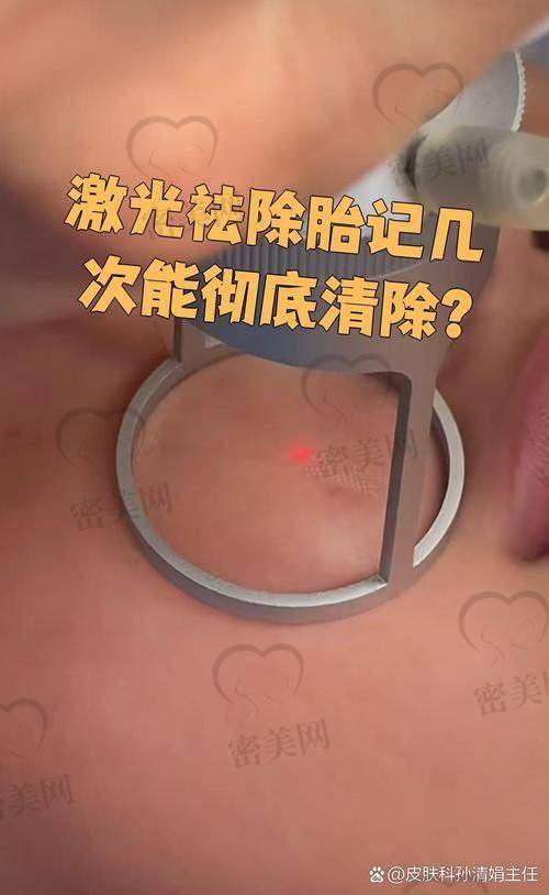 重庆军科疤痕中 心党永明：医生实力大比拼
