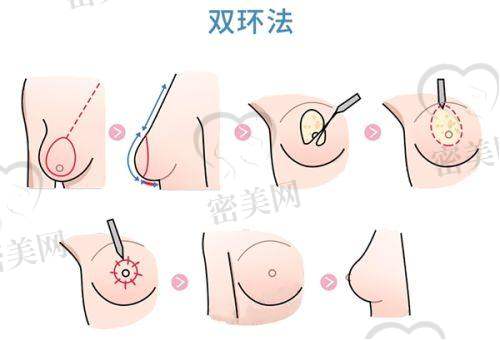 新疆艾美整形医院