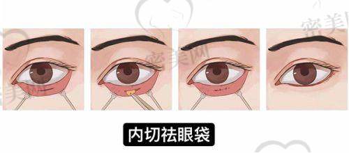 王衡健是杂牌还是行业佼佼者？专精能力见真章