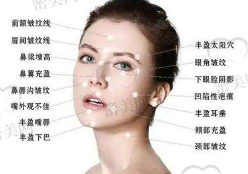 注射乔雅登极致的注意事项