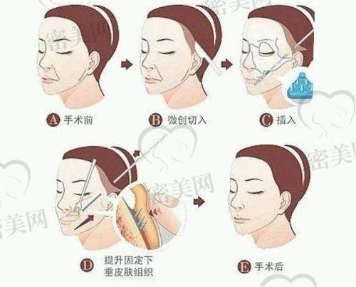 【高海歌医生口碑怎么样？】
