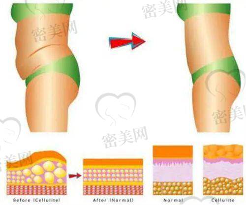 【李会勇医生怎么预约挂号？】