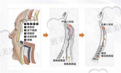 【马瑞医生技术特点】