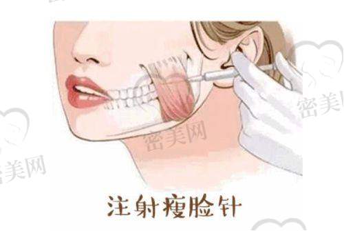 苏州瘦脸针医院推荐榜（附地址信息一览）