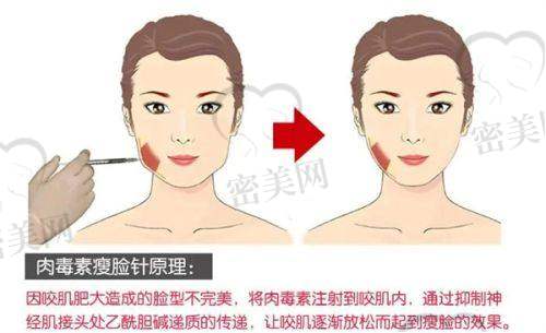 苏州伊美医疗美容医院