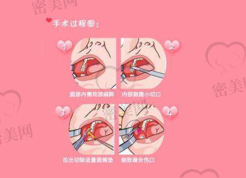 西宁维美医疗美容门诊