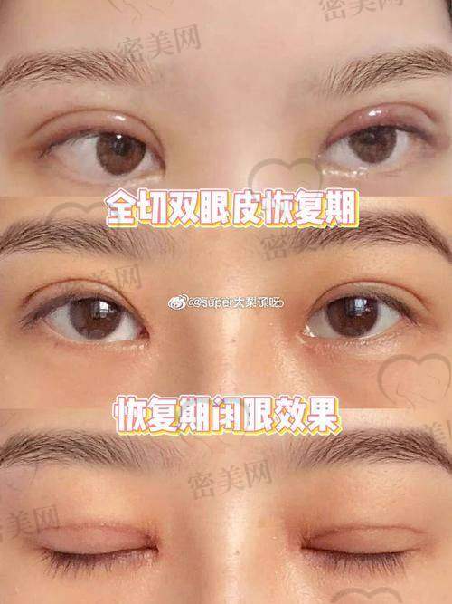 汉中华美奥莱整形项目和收费标准透明吗？