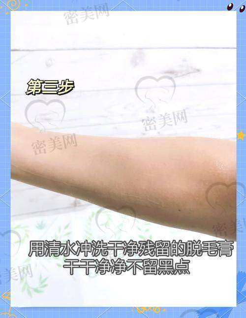 大连连森整形外科医院：操作规范，术后管理严谨
