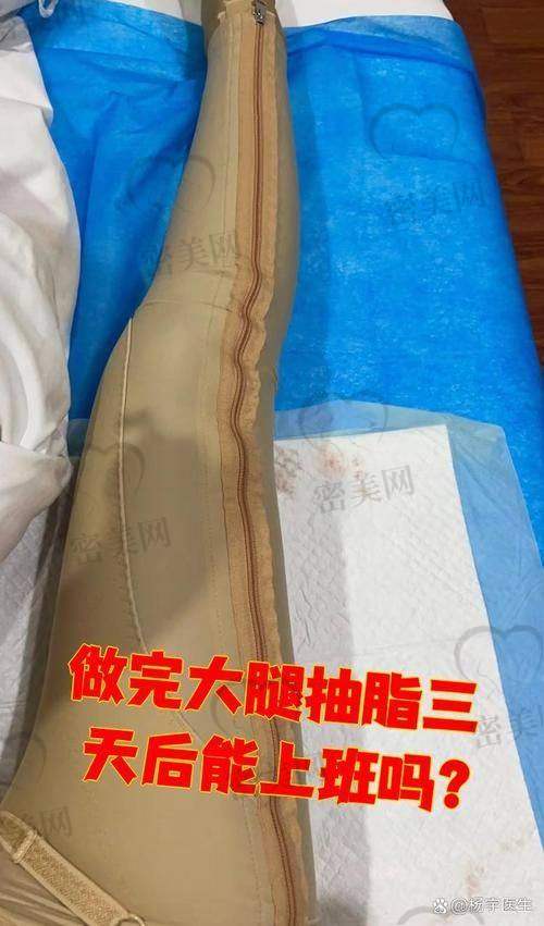 淄博天丽整形医院张镭大腿吸脂：口碑爆棚，真人实例见证！
