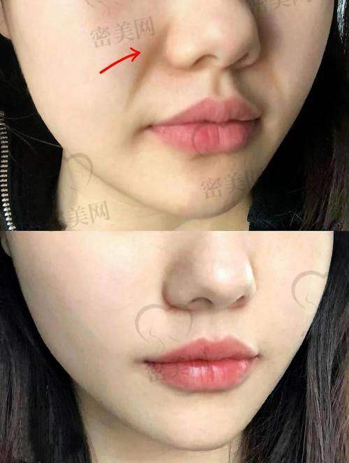 热门医美产品价格