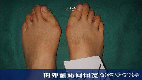 如何预约北京圣嘉新医院苏敬达医生？