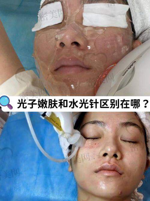 整形医院活动