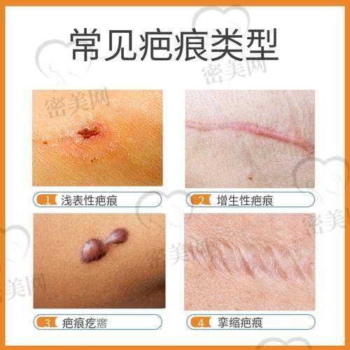 上海疤痕修复医院排行榜一览表