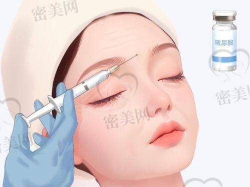 打乔雅登玻尿酸到鼻子的维持时间
