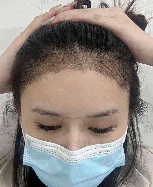 北京碧莲盛养发有啥独特之处？