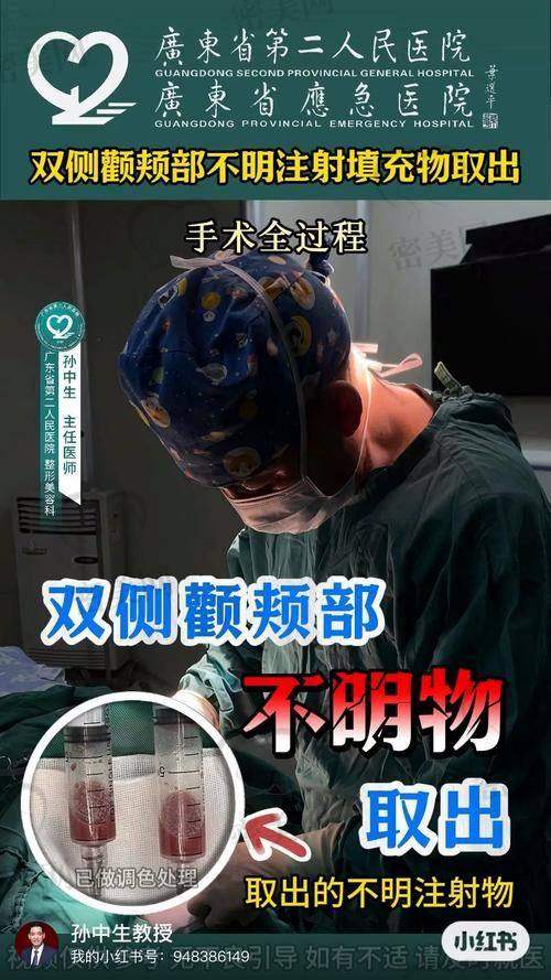 吴贞跃医生馒化脸修复优势大揭秘