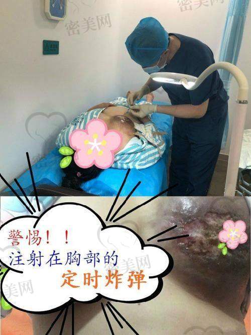 深圳非凡医疗美容医院：术中监测，杜绝神经血管伤害