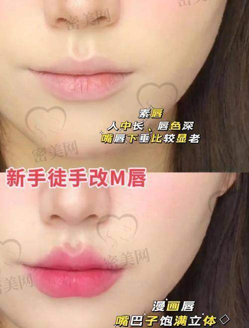 嘟嘟唇手术过程全解析