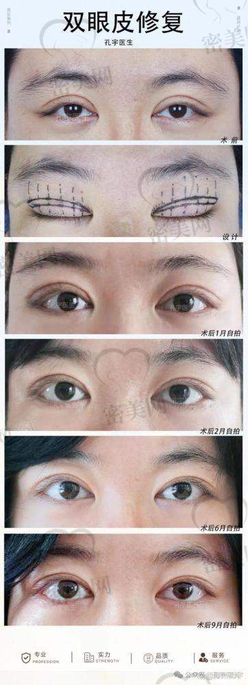 真实顾客评价反馈：高满意度、术后体验良好