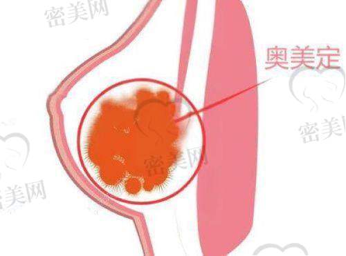 东莞美熙伊美医疗美容门诊部