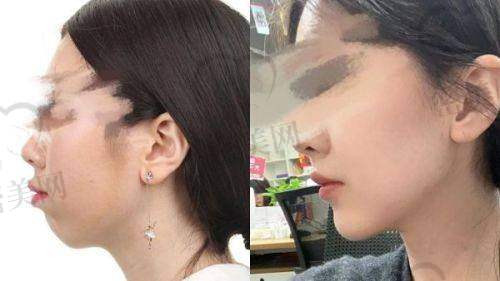 广州美莱医疗美容医院医生团队介绍