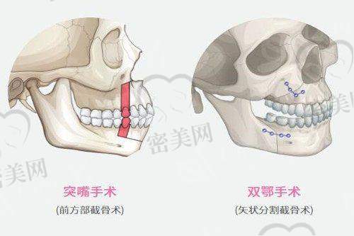 南方医 科 大学南方医院整形科医生推荐TOP阵容