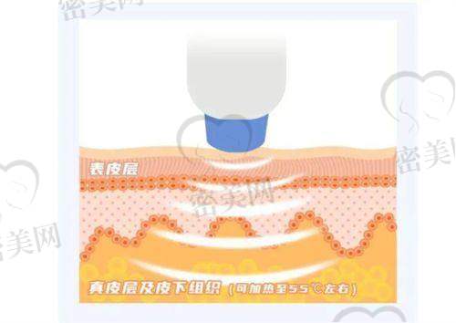 成都禾臣瑞亚医疗美容门诊部：脂肪移植领域“一股清流”