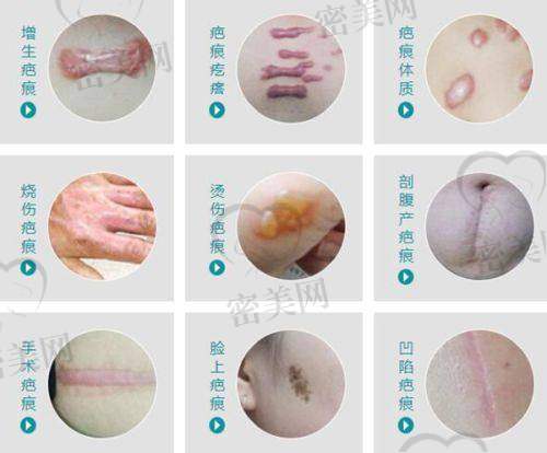 南方医院整形美容科热门项目价格列表（部分）
