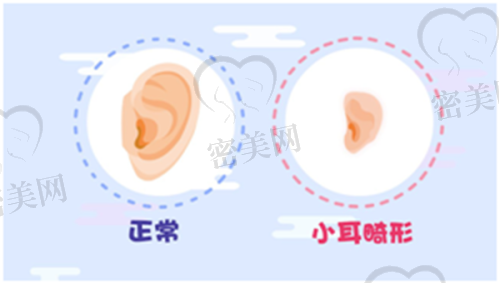 重庆美仑美奂整形医院毋巨龙耳畸形再造：68000 元起的真人实例大展示