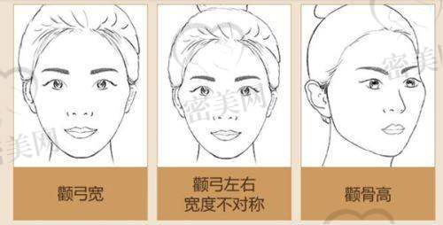 怎么预约南方医院整形外科，流程来啦！