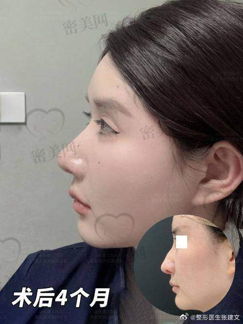 口碑评价：患者的认可就是更好的广告