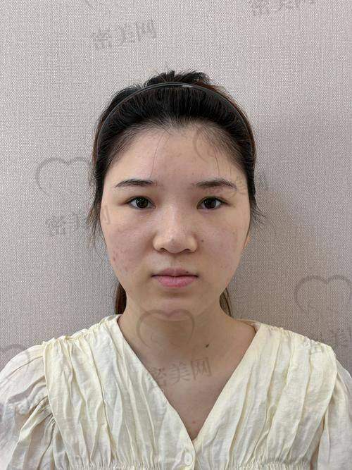 不同填充材料的维持时长和修复时间