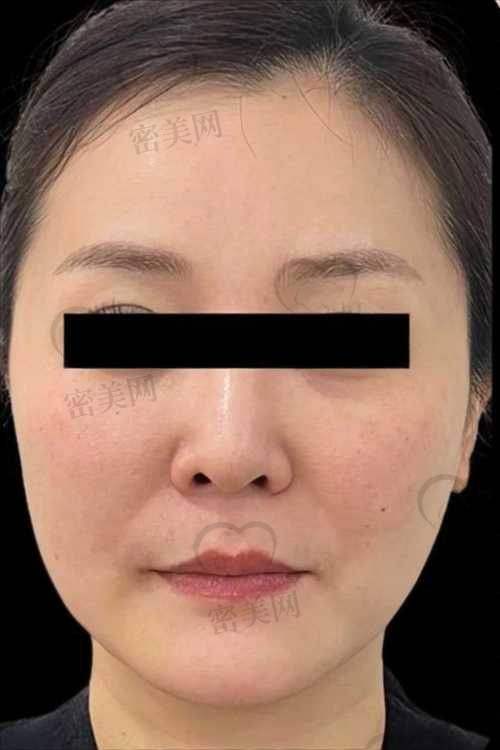 成都西区整形医院：打造稳扎稳打的轮廓提升术