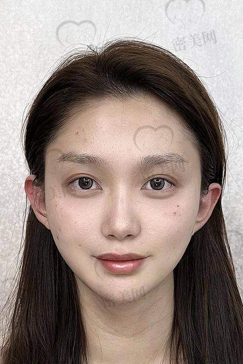 上海联合丽格医疗美容医院：修复&翻车急救站！