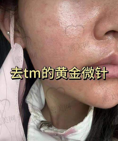 东莞非凡整形医院