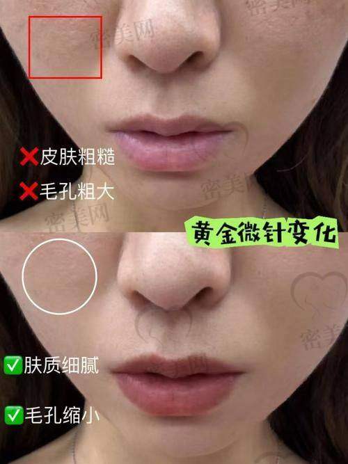 东莞缔美整形医院