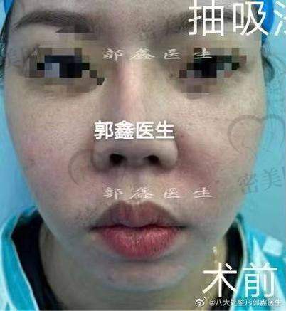 东莞非凡美容医院