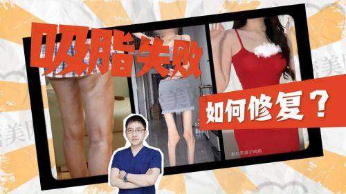 冯斌脂雕项目分类详细介绍及医生梯队划分