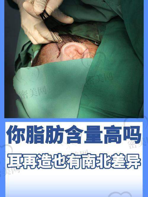 重庆美仑美奂整形医院毋巨龙：68000 元起的耳畸形再造“神操作”价格大揭秘