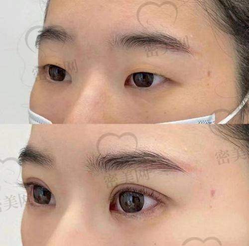 王衡健张诗若谁成就高？能力大较量