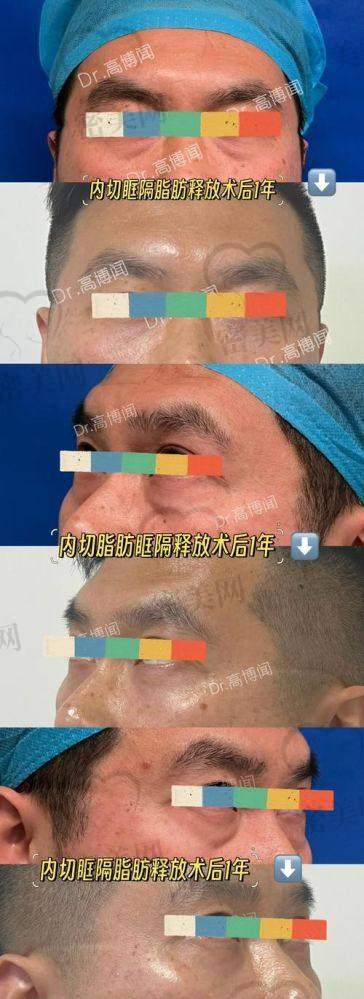 重庆华美紫馨刘天云医生：眼部整形界的名咖