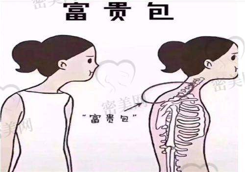 济南美辰整形美容医院——郑美辰医生的细节把控