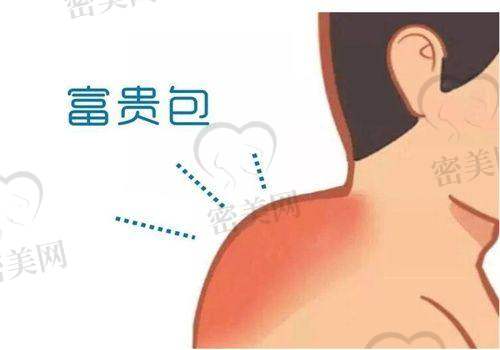 济南瑞丽医疗美容医院——吴瑞丽医生的创新技术
