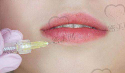 鼻子打玻尿酸后的护理注意事项