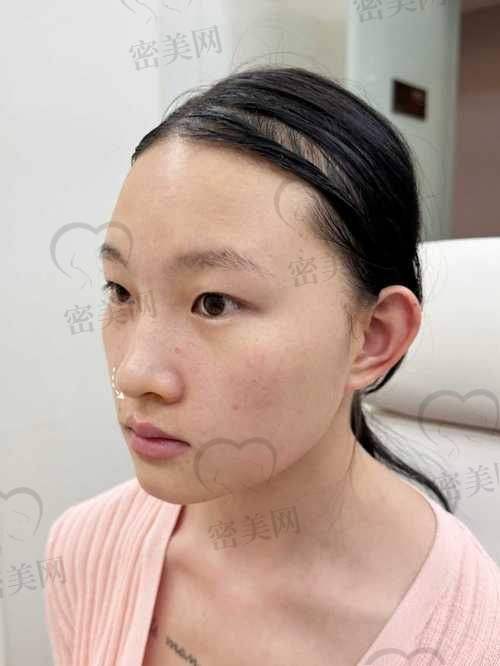 适合不同年龄段的整形搭配方案