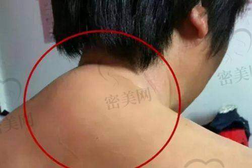 济南伊美尔整形美容医院——周伊美尔医生的成熟方案