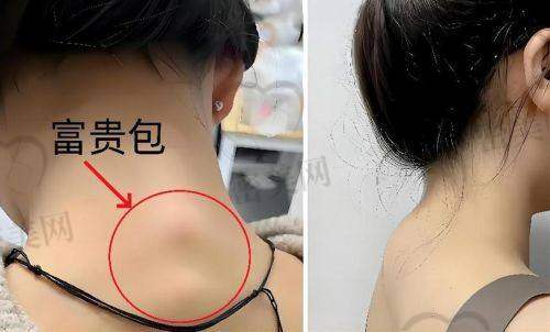 济南美莱整形美容医院——张美莱医生的个性化方案